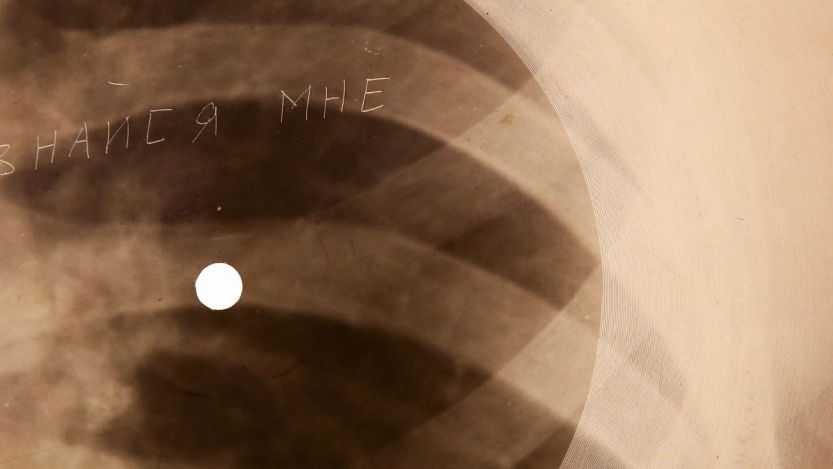 X-ray record