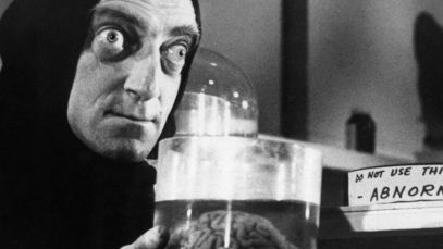 Marty Feldman from 'Young Frankenstein', Mel Brooks comedy