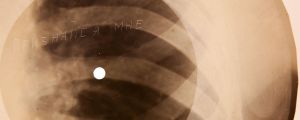 Music on Bones: The Eerie Way Music Lovers Had To Listen to LPs Decades Ago